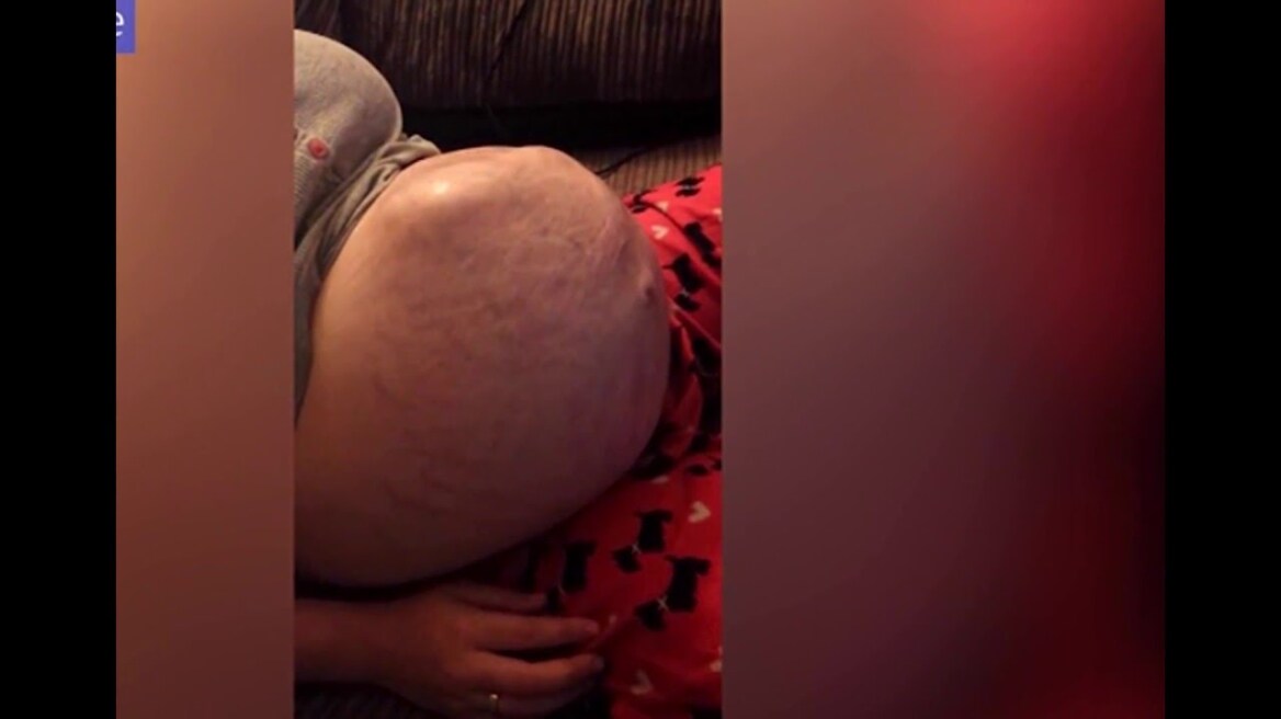 Βίντεο: Δείτε πώς «χορεύει» ένα έμβρυο μέσα στην κοιλιά της μαμάς του!